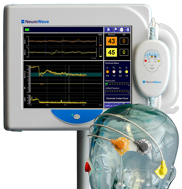 NeuroSENSE Image